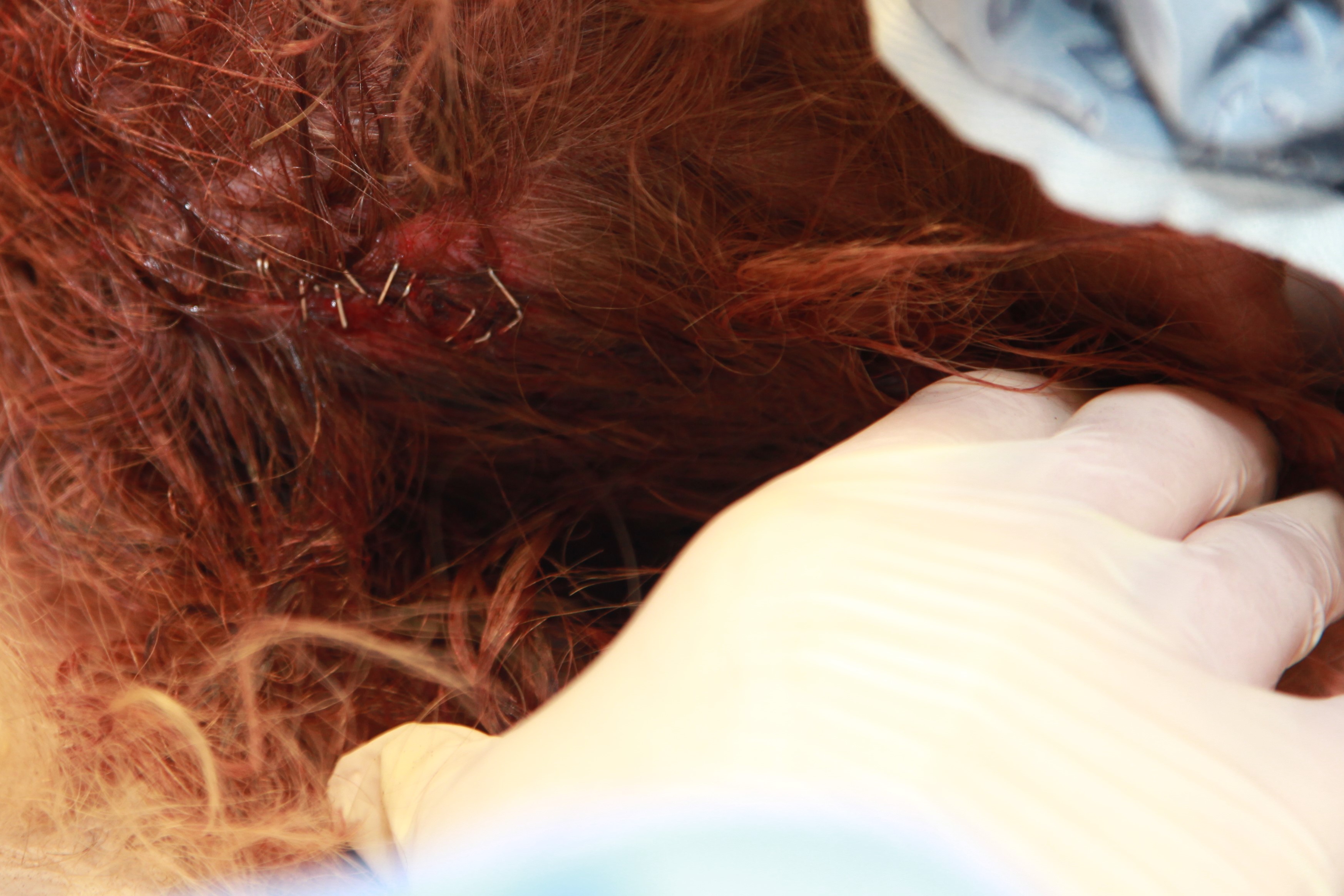 Photo of scalp laceration